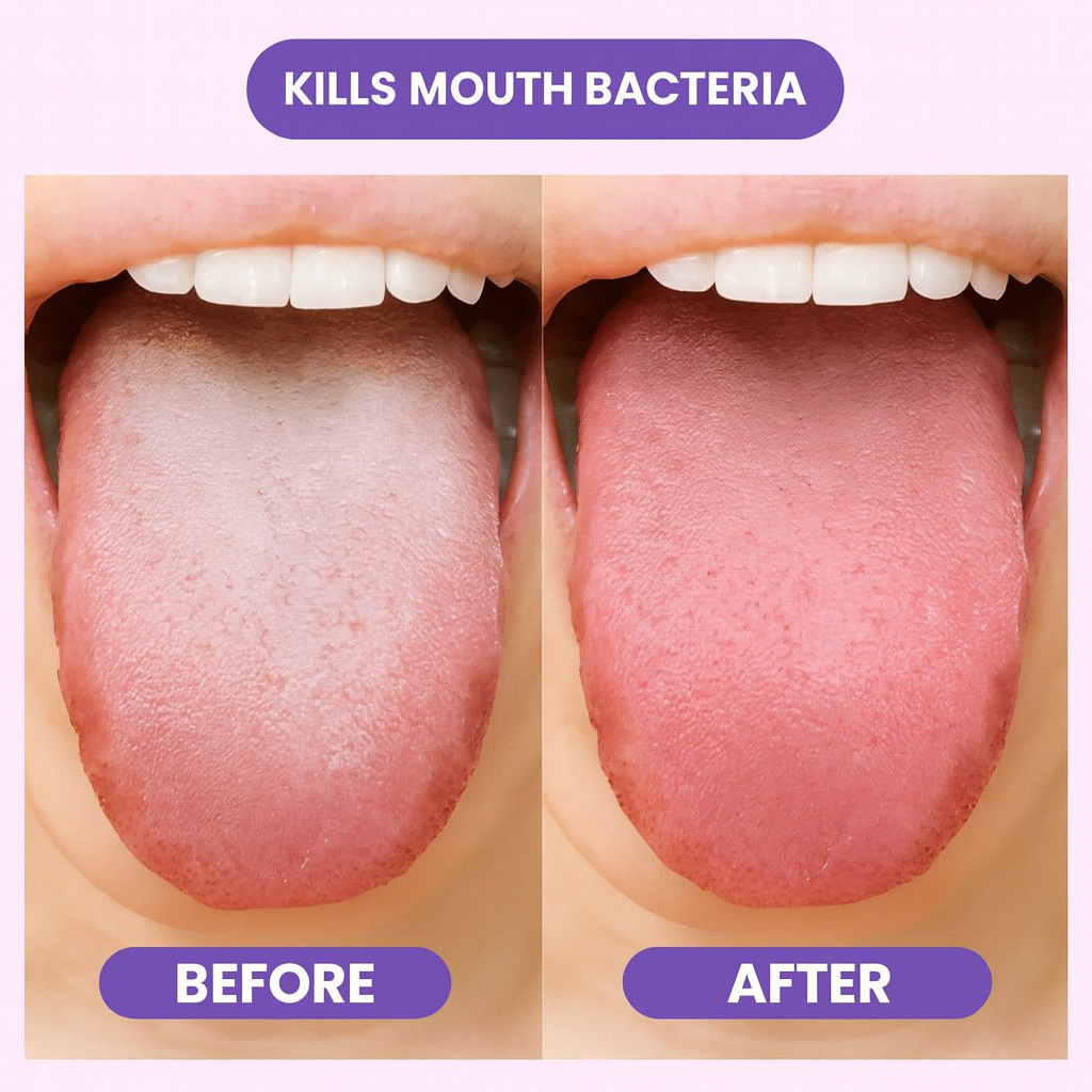 FreshKiss Probiotic Spray